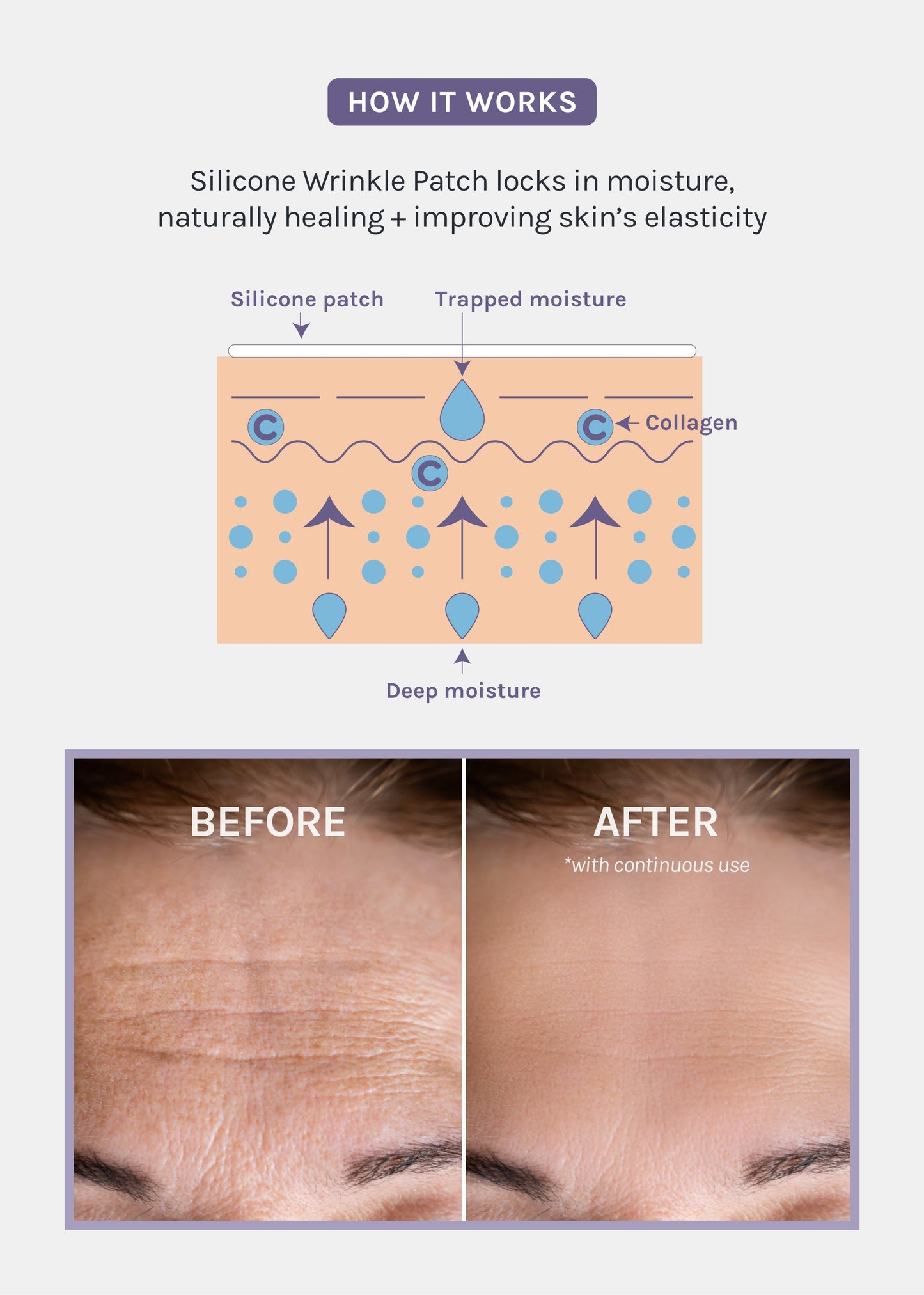 AOA Skin Wrinkle Smoothing Patch – Chest