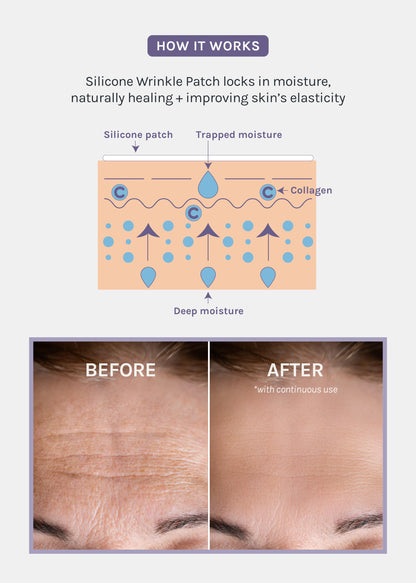 AOA Skin Wrinkle Smoothing Patch – Chest