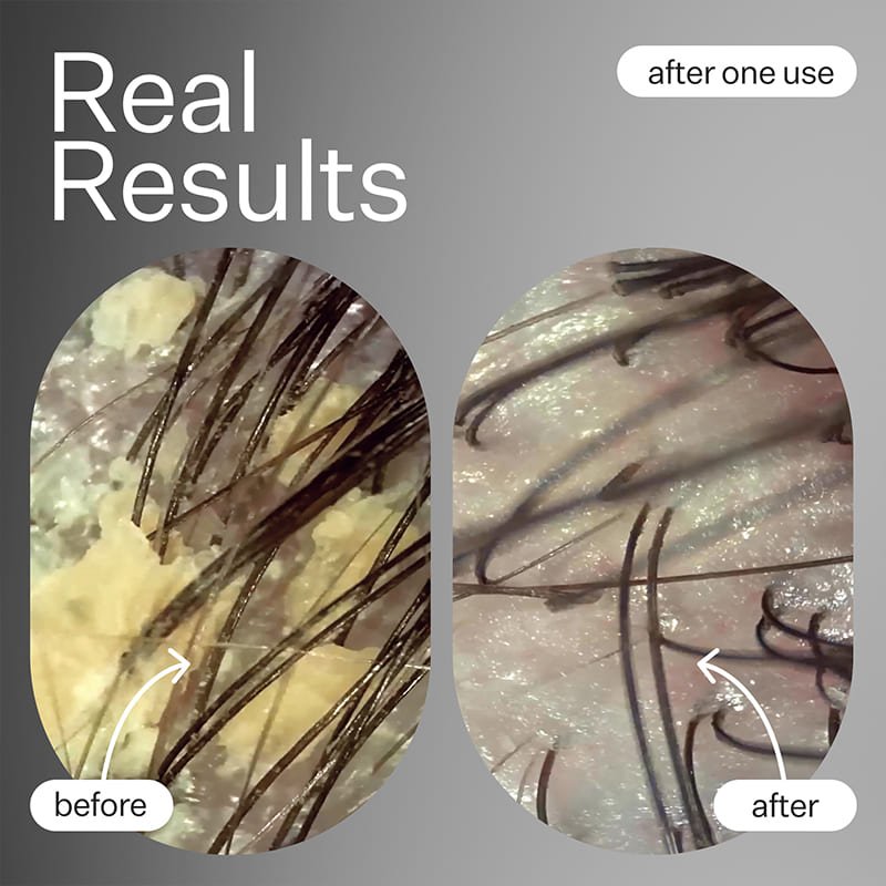 Act+Acre Cold Processed Hair Cleanse Shampoo