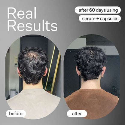 Act+Acre Cold Processed Stem Cell Serum