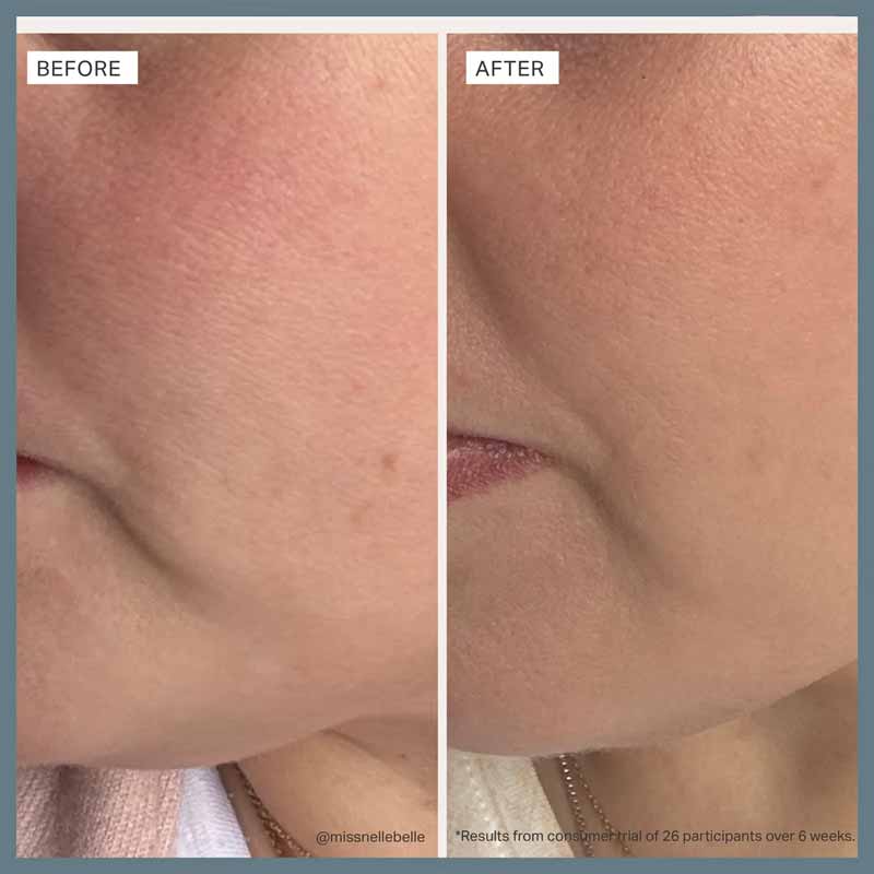 Alpha-H Multi-Peptide Revitalise Serum