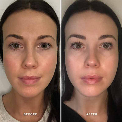 Alpha-H Vitamin B Serum with 5% Niacinamide