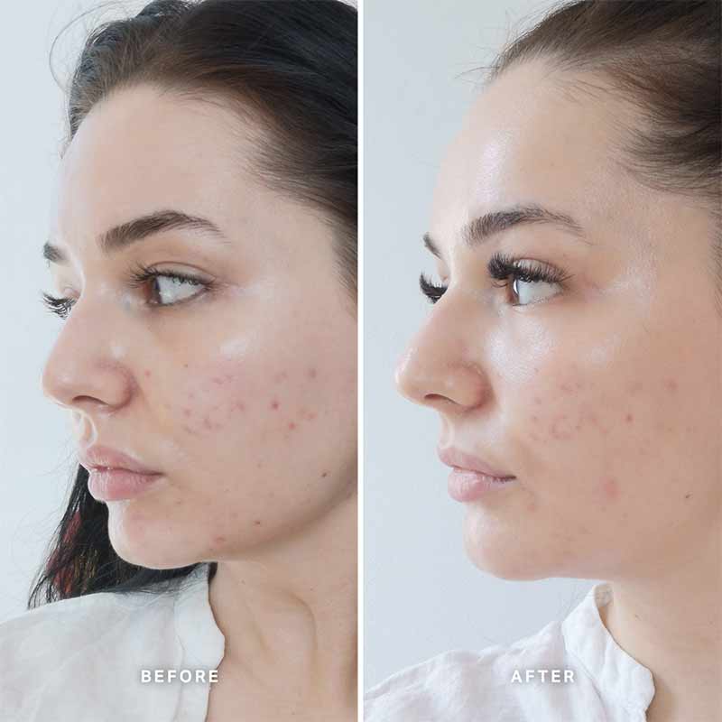 Alpha-H Vitamin B Serum with 5% Niacinamide
