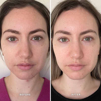 Alpha-H Vitamin B Serum with 5% Niacinamide
