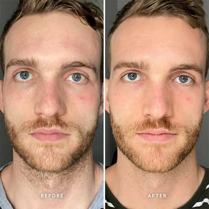 Alpha-H Vitamin B Serum with 5% Niacinamide