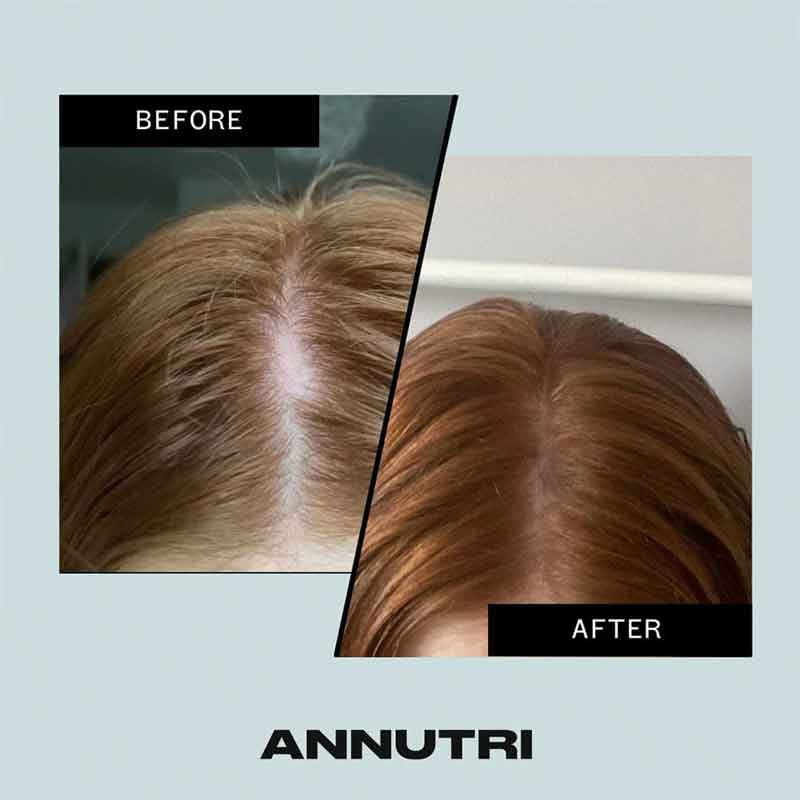 Annutri Grow It Hair Growth Supplement - 1 Month Supply