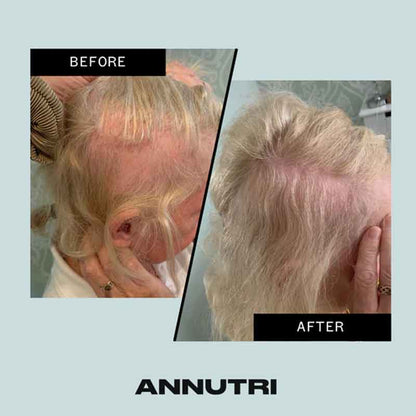 Annutri Grow It Hair Growth Supplement - 1 Month Supply