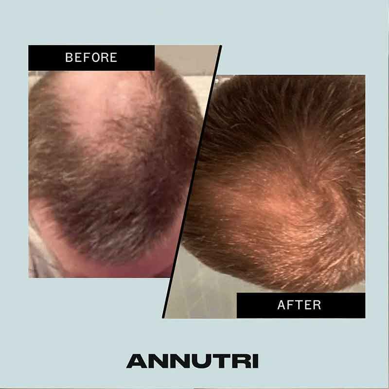Annutri Grow It Hair Growth Supplement - 1 Month Supply