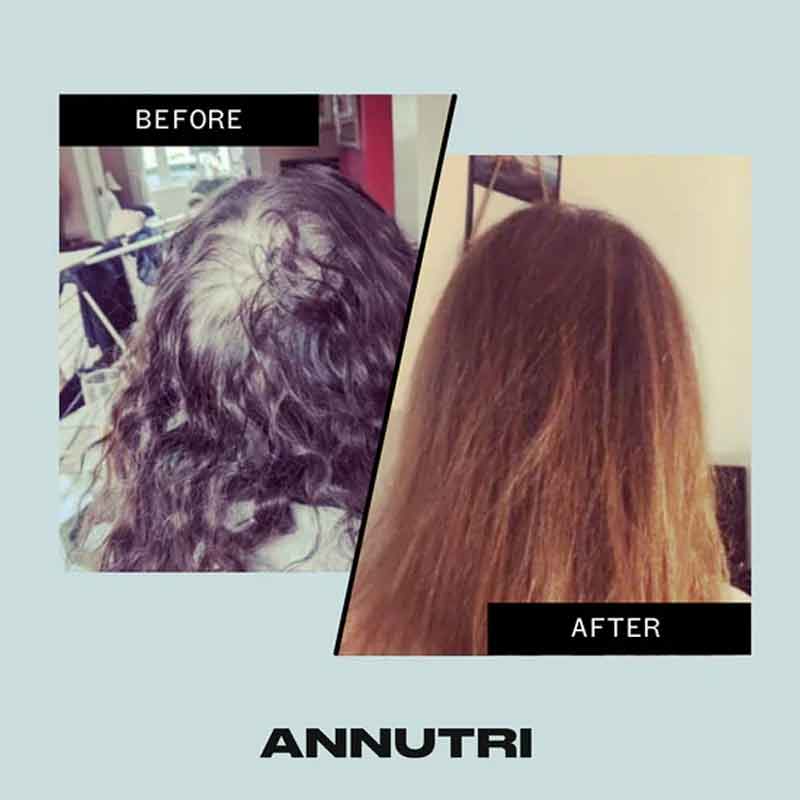 Annutri Grow It Hair Growth Supplement - 1 Month Supply