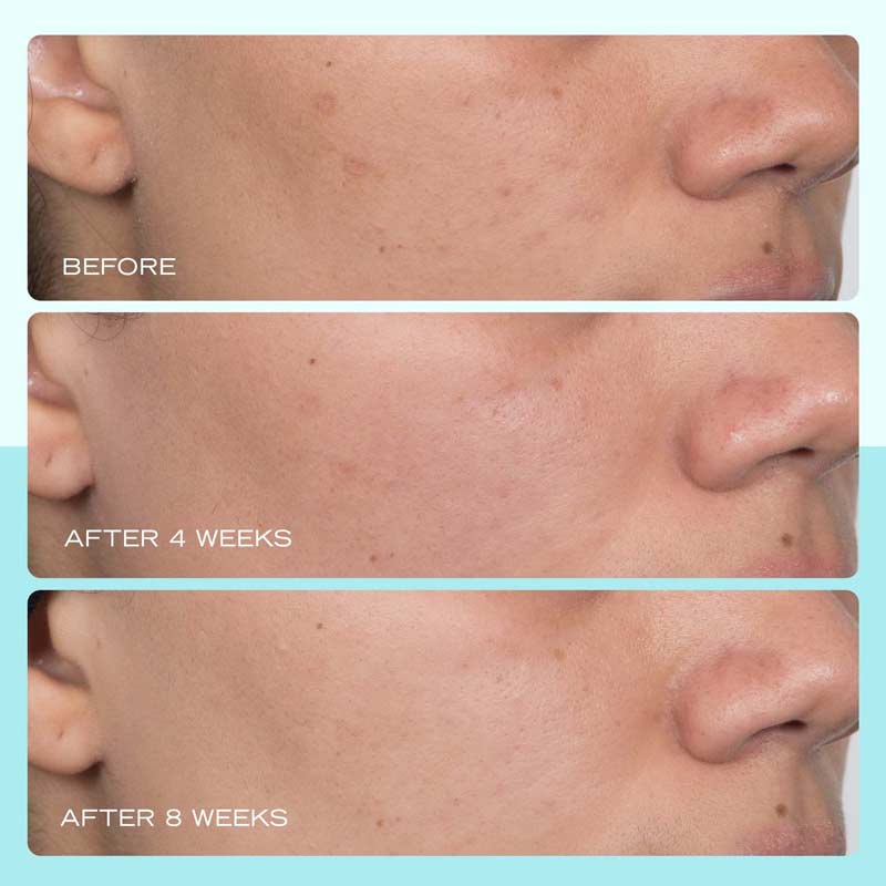 First Aid Beauty Dark Spot Serum with Niacinamide Discontinued