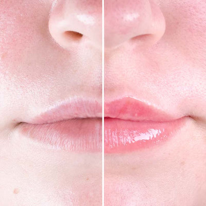 iGlow Chili Lips Lip Plumper