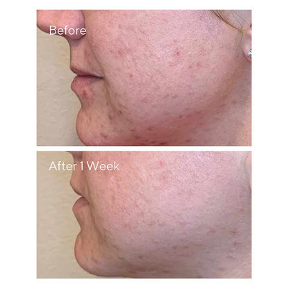 Murad Daily Clarifying Peel