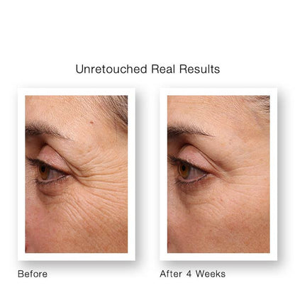 Murad Resurgence Retinol Youth Renewal Eye Serum