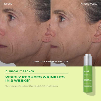 Murad Resurgence Retinol Youth Renewal Oil Drops