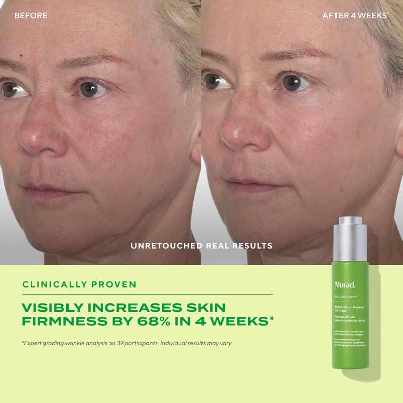 Murad Resurgence Retinol Youth Renewal Oil Drops